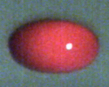 A levitated drop of blood oscillating during acoustic tweezing measurements