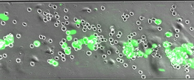 Human monocytes anchor circulating breast cancer cells to vascular endothelium