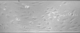 Human monocyte rolling on HUVEC