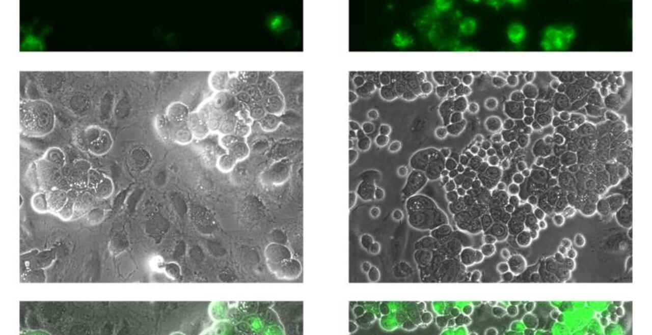 LPS-activated monocytes