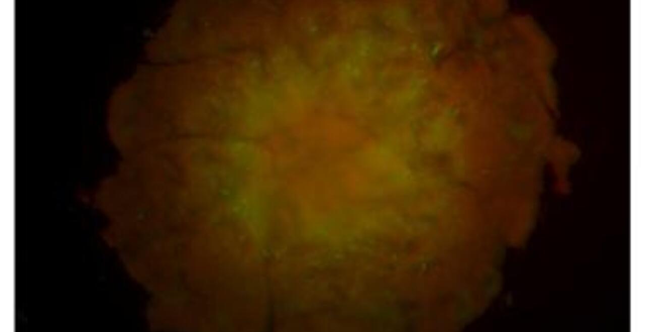 HepG2 Spheroids