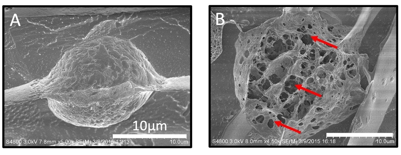 Mechanical disruption of human prostate cancer cells by FUS