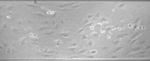 Human monocyte rolling on HUVEC