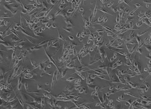Resting human macrophages activated by oxLDL