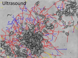 Neurite outgrowth post ultrasound exposure
