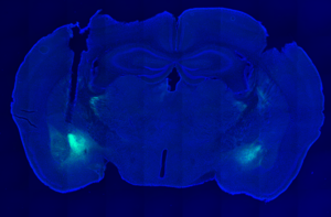 Halorhodopsin Imaging of Mouse Brain