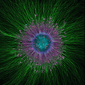 Female hi-PSC SCDH Neurite outgrowth