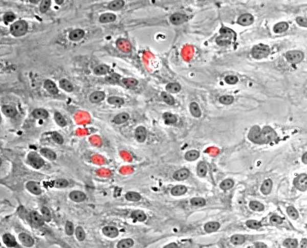 Proliferating endothelial cells
