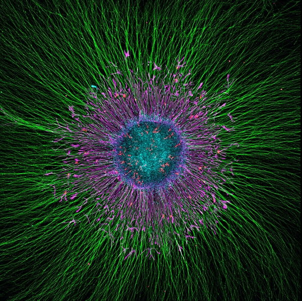 Female hi-PSC SCDH Neurite outgrowth